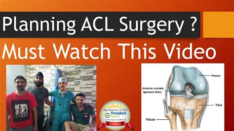 Acl Surgery Walkthrough