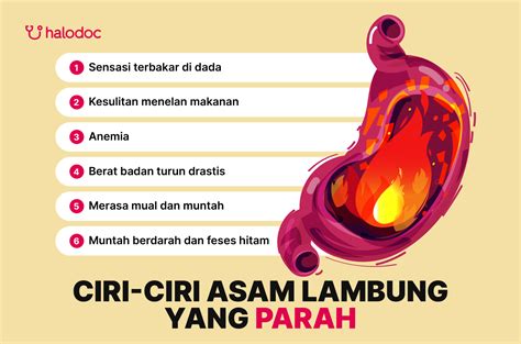 Asam Lambung