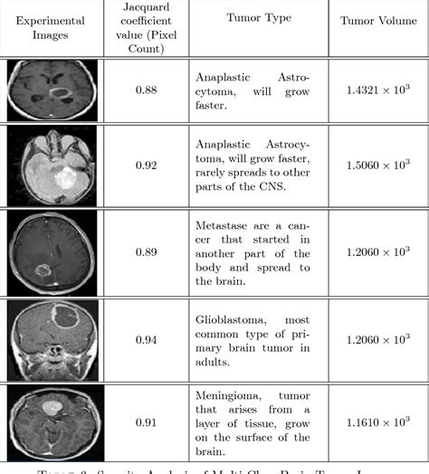 Brain Tumor Size Chart