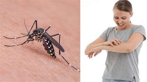 cara mengatasi bekas gigitan nyamuk