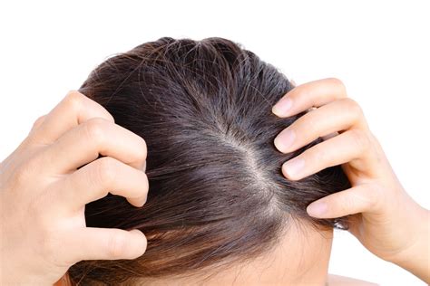 cara mengatasi gatal di kulit kepala