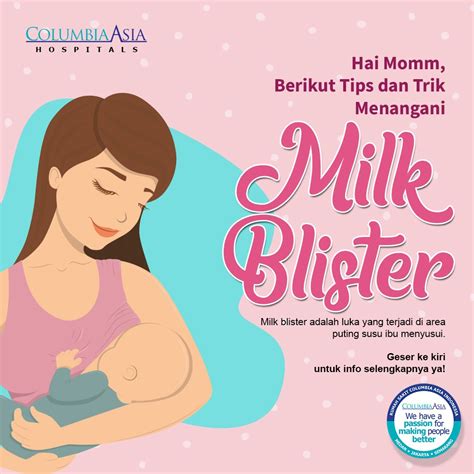 cara mengatasi milk blister