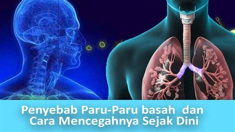 cara mengatasi penyakit paru paru basah