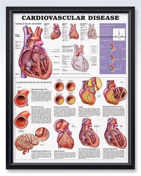 Cardiovascular Disease Chart