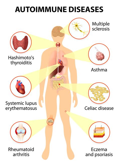 diseases in human body