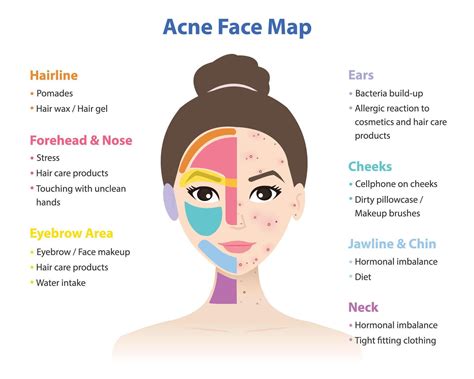 Face Chart For Pimples