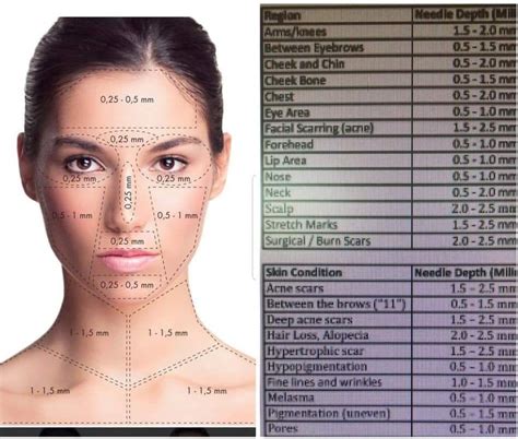 Face Mapping Microneedling Face Chart