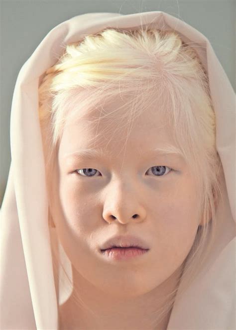 jenis albino