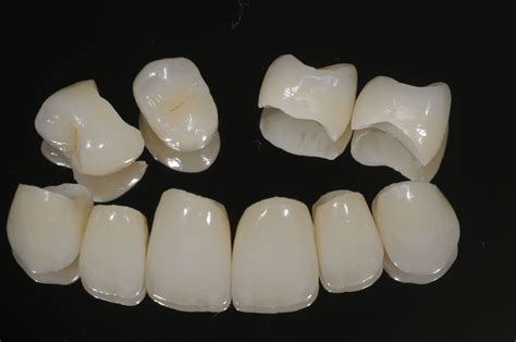 Porcelain Crown Cost with Insurance