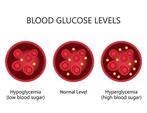 Random Blood Glucose Level Chart