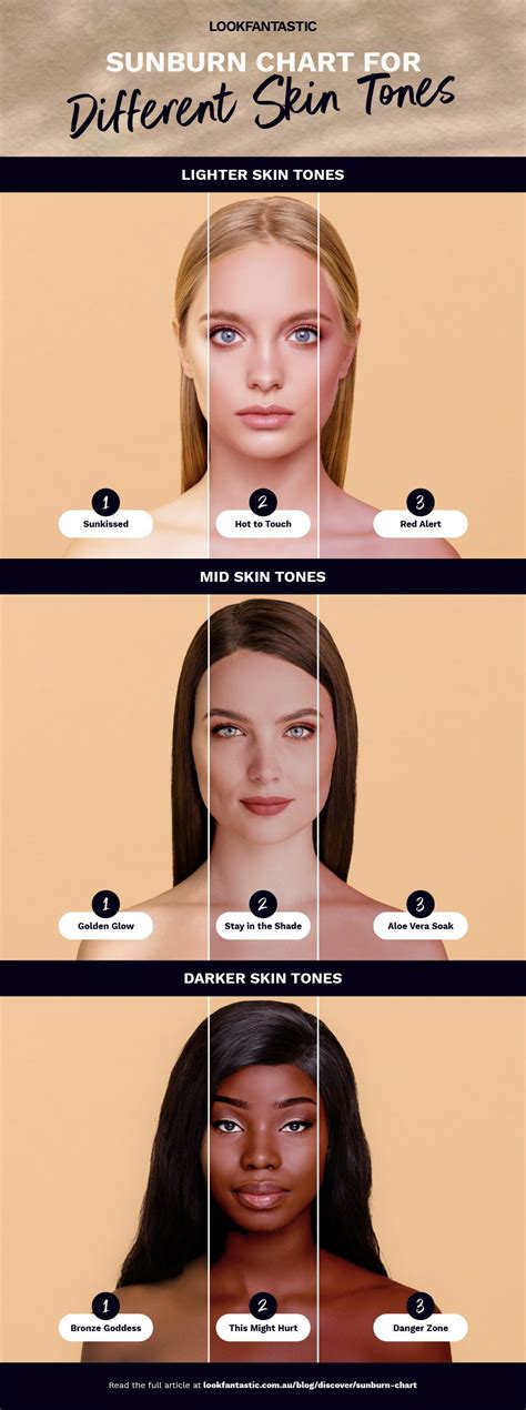 Second Degree Color Sunburn Severity Chart