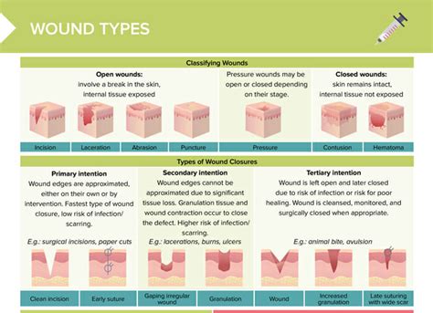 Types Of Wounds Chart