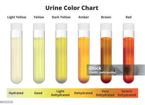 Urine Colour Test Chart