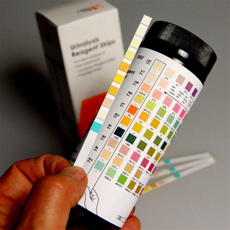 Urine Strip Test Chart