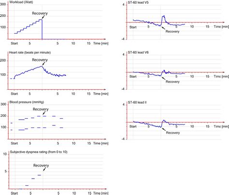 what is normal blood pressure during stress test