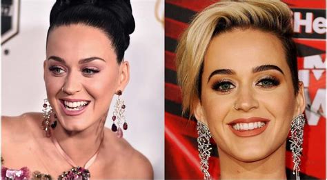 why doesn't katy perry fix her teeth