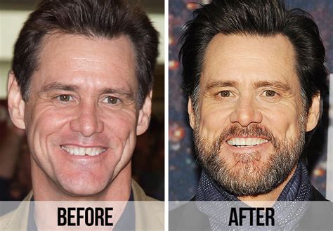 worst teeth in hollywood